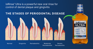 banner image for: Is Brushing & Flossing Alone The Best Way To Prevent Periodontal Disease? Maybe Not.